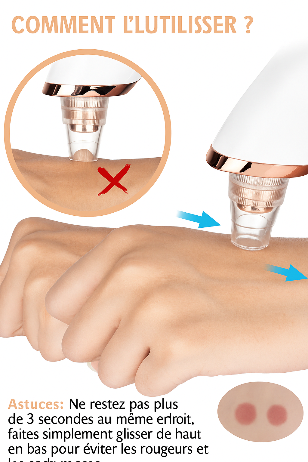 ASPIRATEUR DE POINTS NOIRS MULTIFONCTIONS